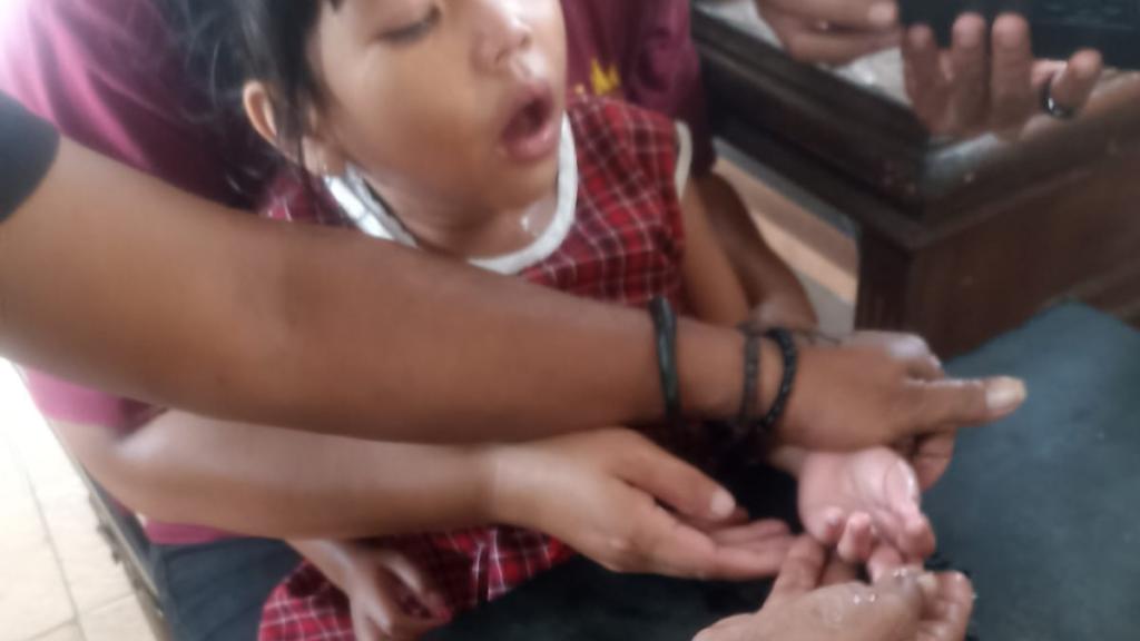 Damkar Kota Tasikmalaya Bantu Warga Lepaskan Cincin yang Terjebak di Jari Anak