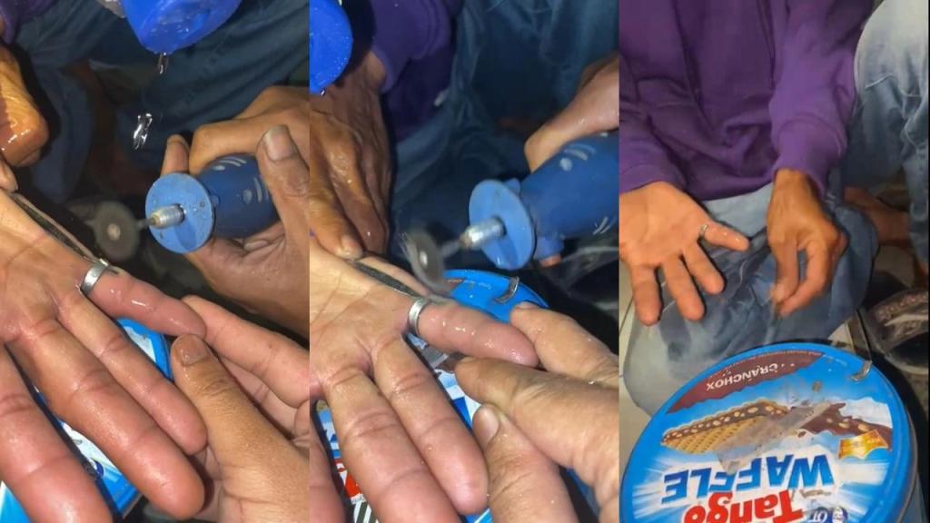 Petugas BPBD Kota Tasikmalaya Potong Cincin di Jari Pekerja Bangunan yang Merekat Akibat Lem