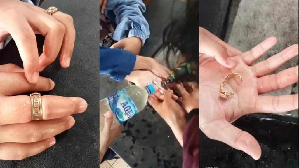 Lagi! Cincin Tak Bisa Dilepas, Damkar Kota Tasikmalaya Lakukan Evakuasi di Jari Tangan Wanita