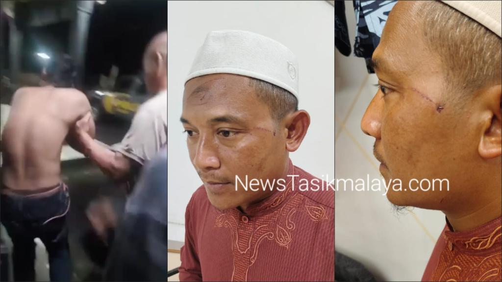 Begini Kondisi Ustaz Ciamis yang Diserang Pemuda Mabuk Pakai Taring Babi di Tasikmalaya