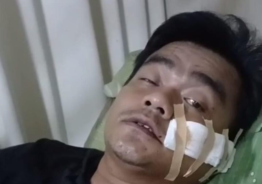 Pengemudi GrabCar Dibacok Orang Tak Dikenal di Sekitar Stasiun Banjar