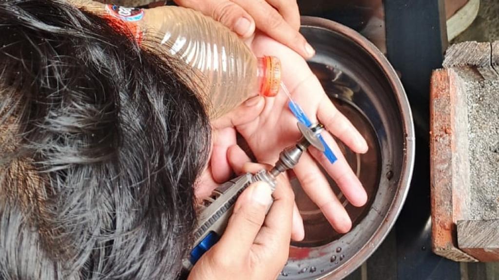 Jari Remaja di Ciamis Bengkak Akibat Cincin Tak Bisa Dilepas, Damkar Rancah Evakuasi dengan Gerinda