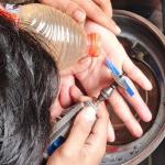 Jari Remaja di Ciamis Bengkak Akibat Cincin Tak Bisa Dilepas, Damkar Rancah Evakuasi dengan Gerinda