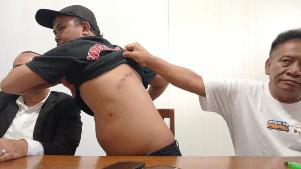 Korban Pembacokan di Jalan SL Tobing Tasikmalaya: Saya Kenali Wajah Pelaku, Tidak Ada Salah Tangkap