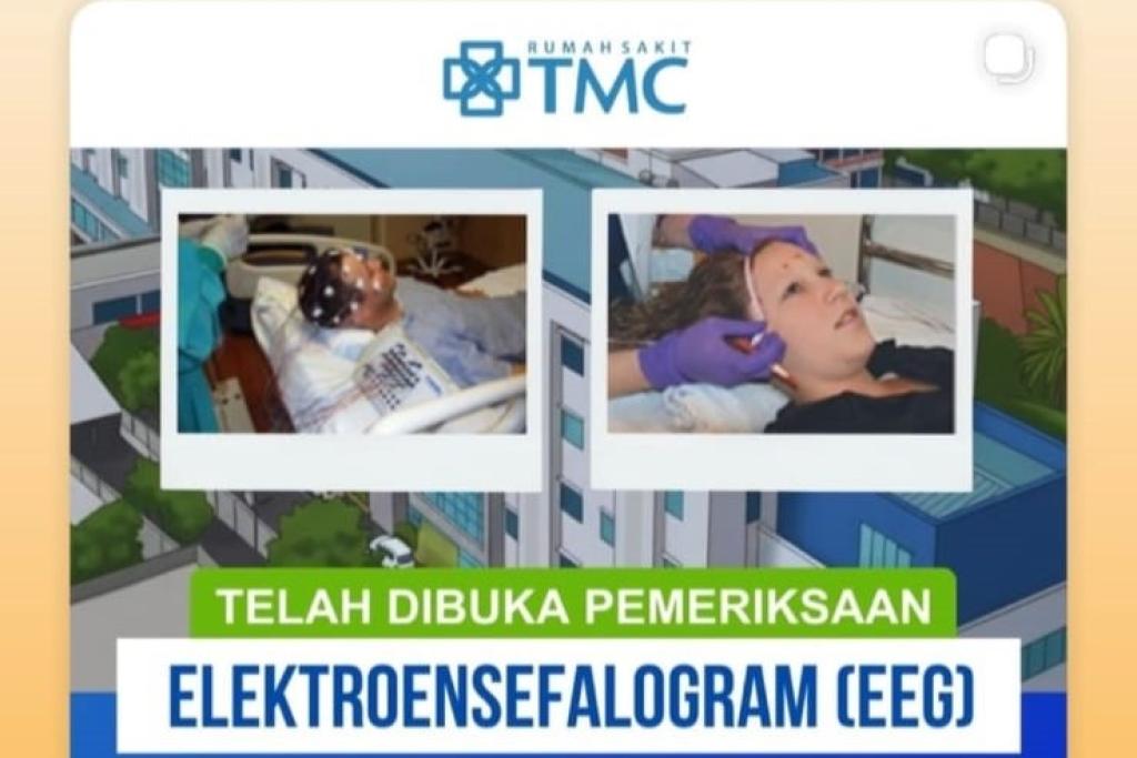RS TMC Tasikmalaya Resmi Buka Layanan Pemeriksaan EEG untuk Deteksi Gangguan Saraf Otak