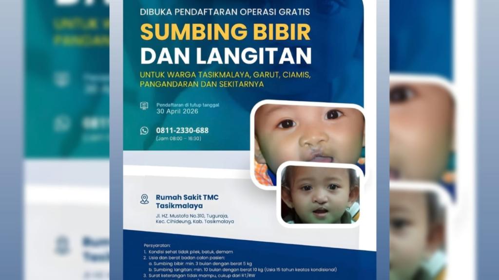 RS TMC Tasikmalaya Buka Pendaftaran Operasi Gratis Sumbing Bibir dan Langitan, Ini Syaratnya