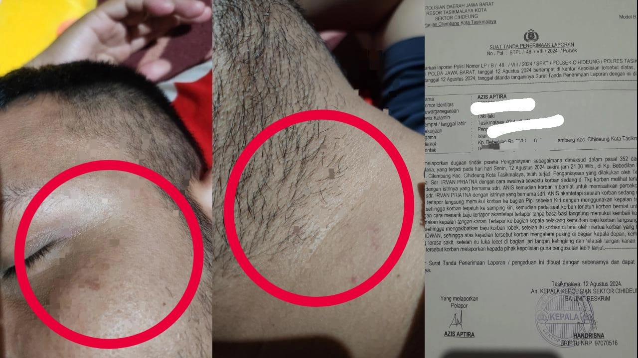 Lerai Pertikaian Suami-Istri, Pengacara di Tasikmalaya Jadi Korban Penganiayaan